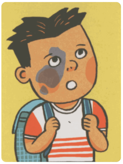 不簡單的生活人物卡-胎記男孩-min